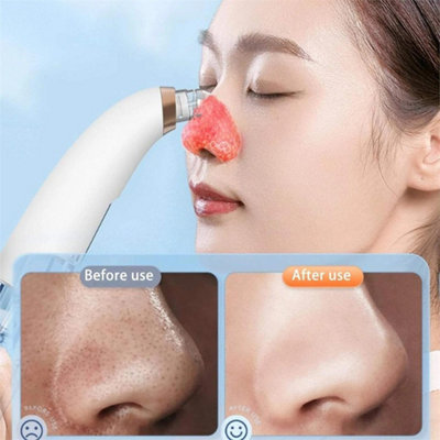 Electric Facial Blackhead Remover Vacuum Pore Cleaner Skin Face Machine ...