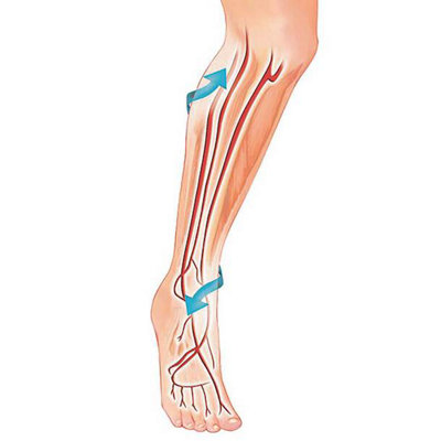 Vital Legs - Compression Socks