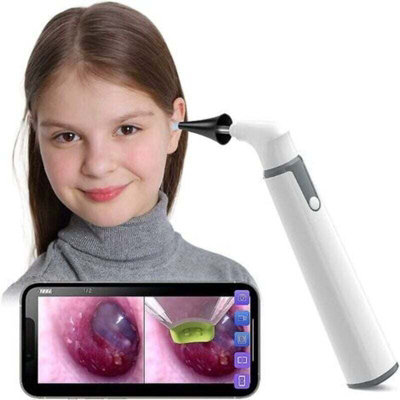 Wireless Otoscope Ear Camera With Dual View, 3.9Mm Ear Scope With 6 Led ...